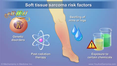 how to test for soft tissue sarcoma|soft tissue sarcoma leg prognosis.